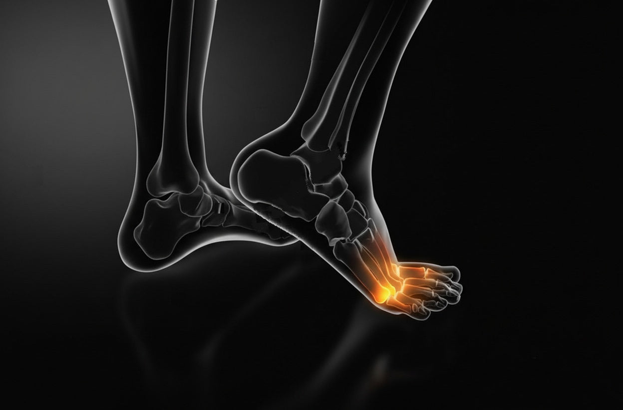 Metatarsal & Bunion