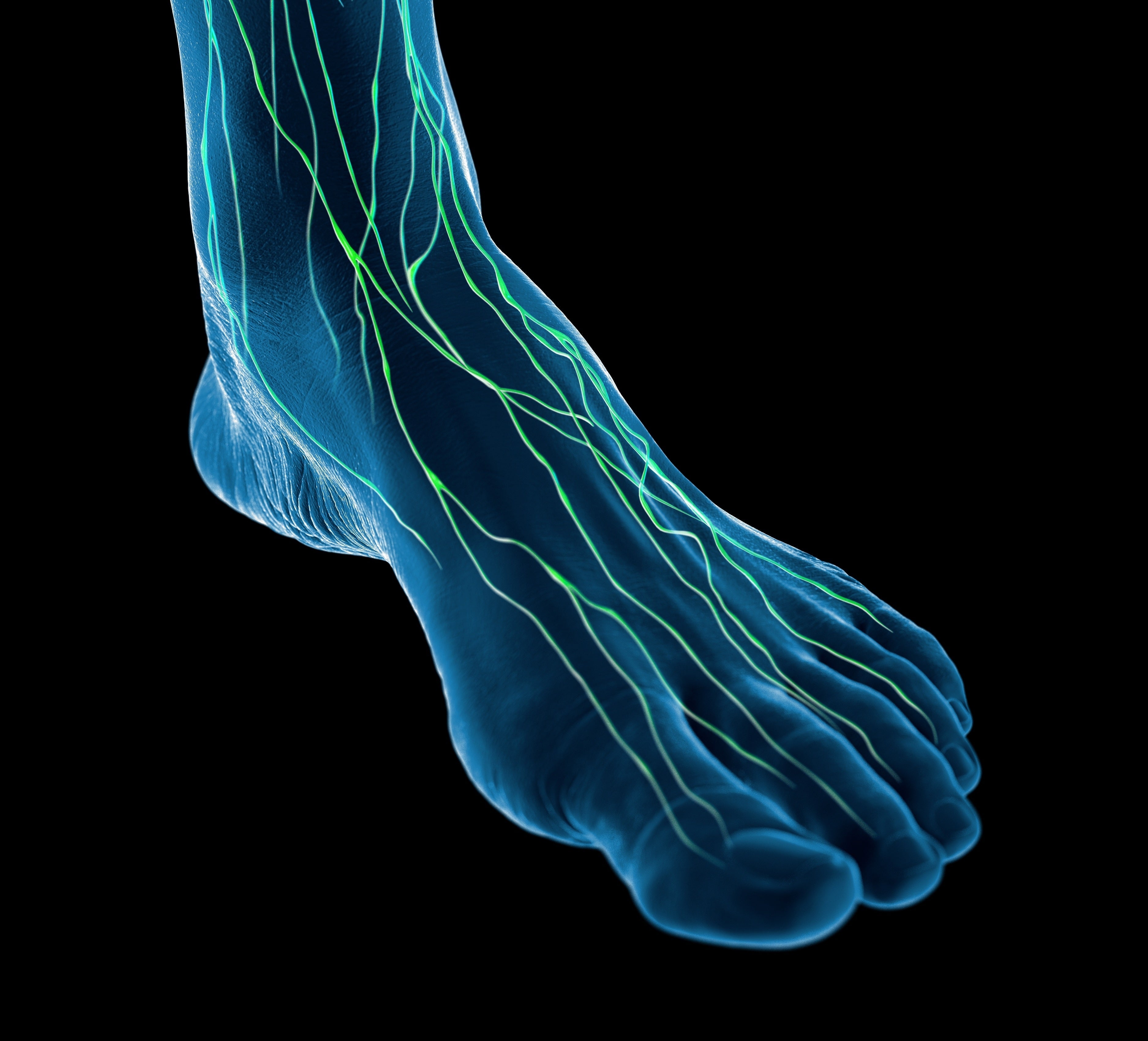 Diabetic Foot
